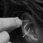 ear with needles